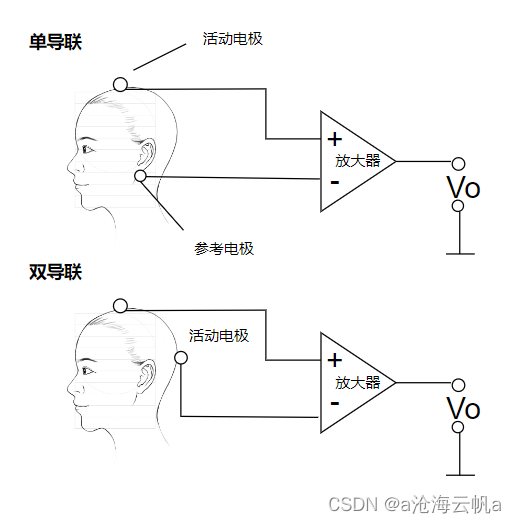 脑电图（EEG）信号去噪方法简述